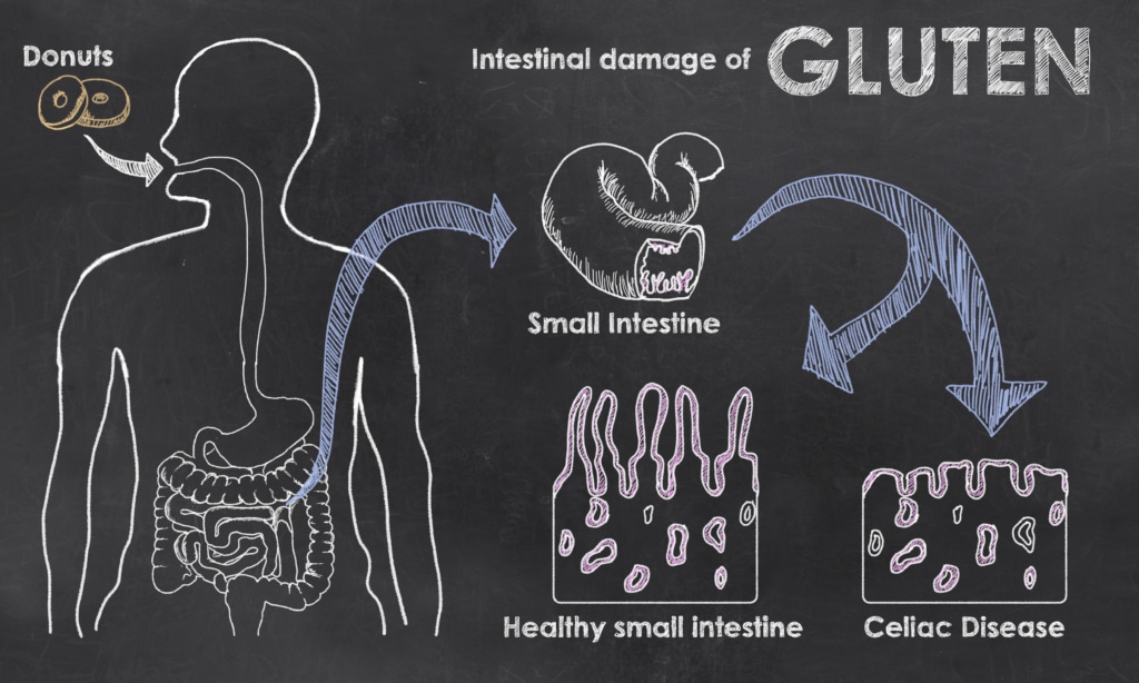 action du gluten intestin