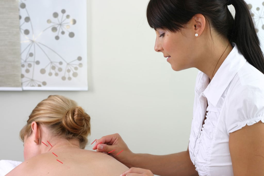 maigrir par acupuncture